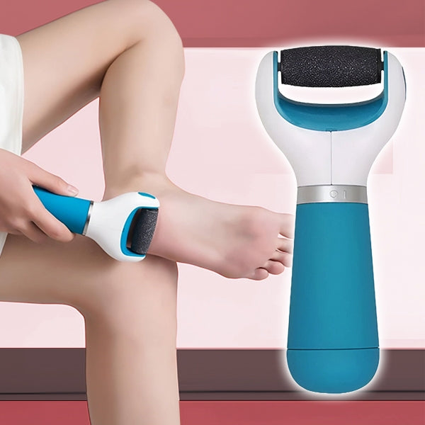 Electric Callus Remover for Smooth Feet