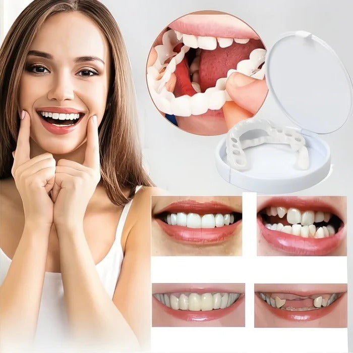 Veneers for Teeth with Natural White Finish