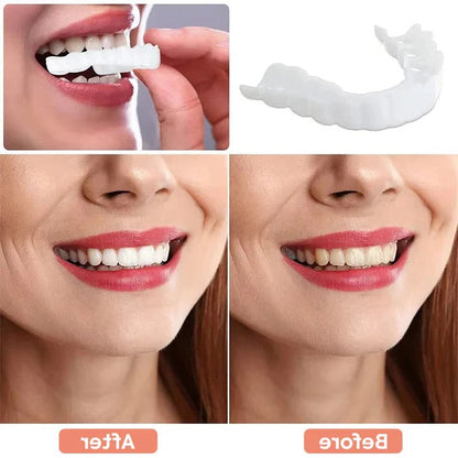 Veneers for Teeth with Natural White Finish