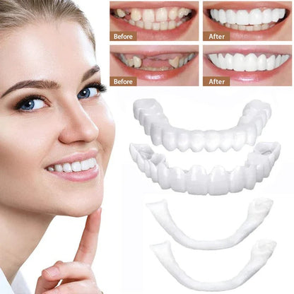 Veneers for Teeth with Natural White Finish
